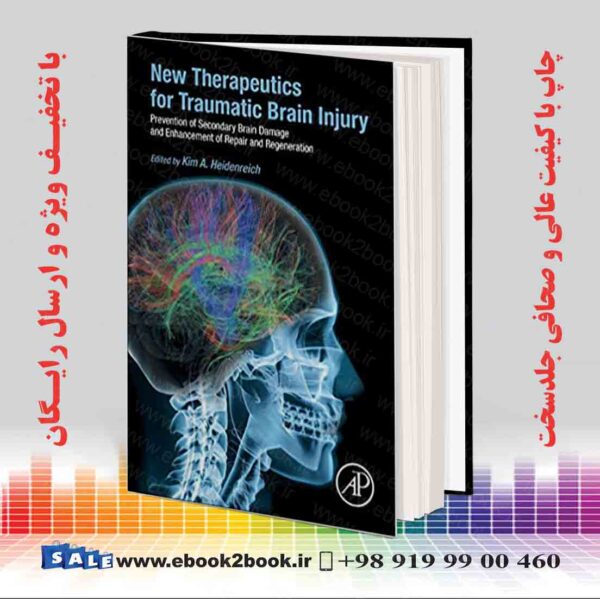 کتاب New Therapeutics For Traumatic Brain Injury