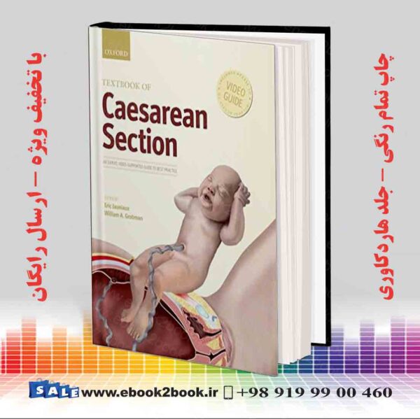 کتاب Textbook Of Caesarean Section