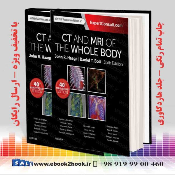 کتاب Ct And Mri Of The Whole Body, 2-Volume Set 6Th Edition