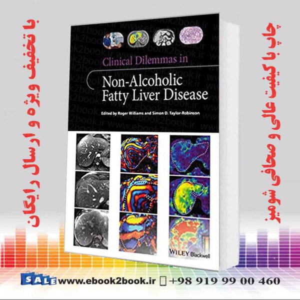 خرید کتاب Clinical Dilemmas In Non-Alcoholic Fatty Liver Disease