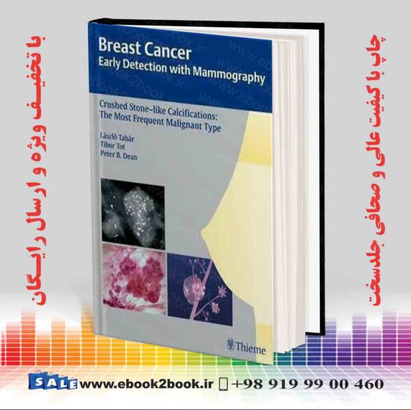 کتاب Breast Cancer: Early Detection With Mammography