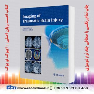 خرید کتاب Imaging of Traumatic Brain Injury 1st Edition