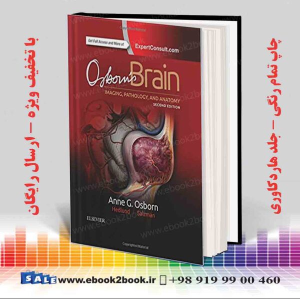 خرید کتاب Osborn'S Brain 2Nd Edition