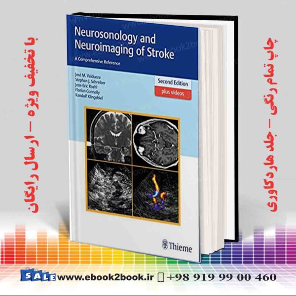 خرید کتاب Neurosonology And Neuroimaging Of Stroke 2Nd Edition