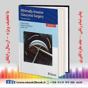 کتاب Minimally Invasive Glaucoma Surgery