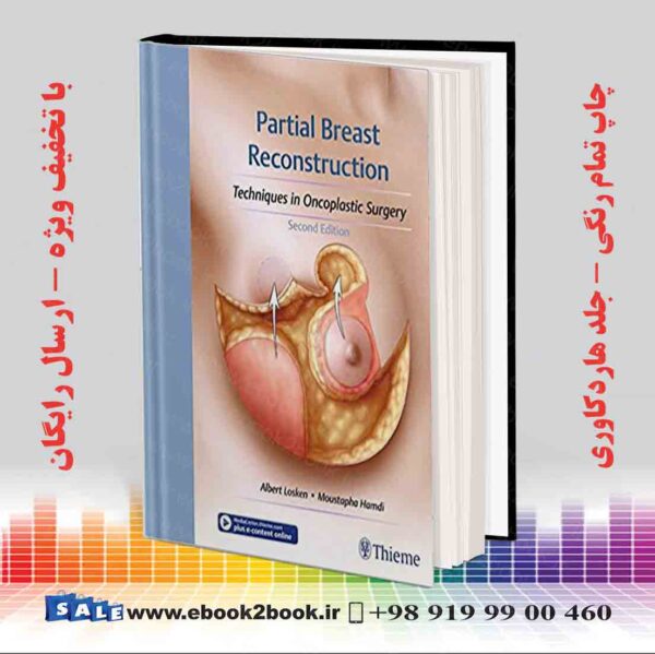 کتاب Partial Breast Reconstruction 2Nd Edition