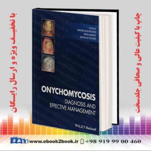 کتاب Onychomycosis: Diagnosis and Effective Management