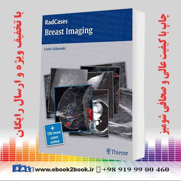 کتاب Radcases Breast Imaging