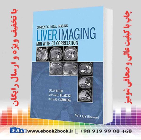 کتاب Liver Imaging: Mri With Ct Correlation (Current Clinical Imaging) 