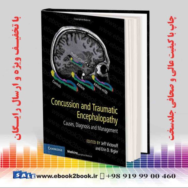 خرید کتابConcussion And Traumatic Encephalopathy: Causes, Diagnosis And Management 