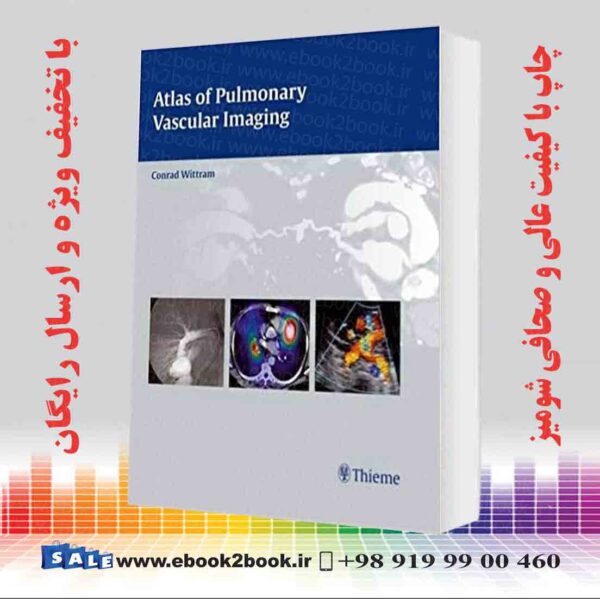 کتاب Atlas Of Pulmonary Vascular Imaging