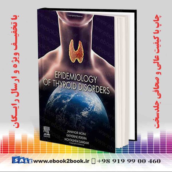 کتاب Epidemiology Of Thyroid Disorders