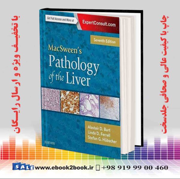 کتاب Macsween'S Pathology Of The Liver 7Th Edition