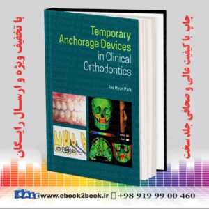 خرید کتاب پزشکی Temporary Anchorage Devices in Clinical Orthodontics