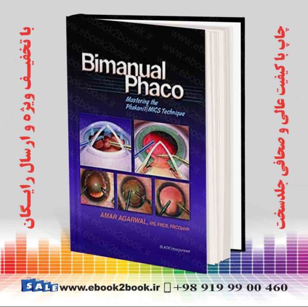 کتاب Bimanual Phaco: Mastering The Phakonit/Mics Technique