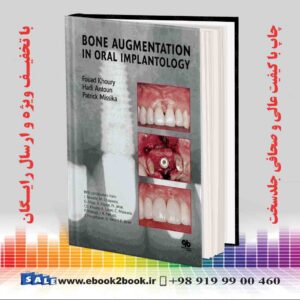 کتاب تقویت استخوان در ایمپلنتولوژی دهان