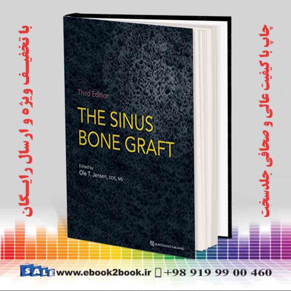 خرید کتاب پزشکی The Sinus Bone Graft 3Rd Edition