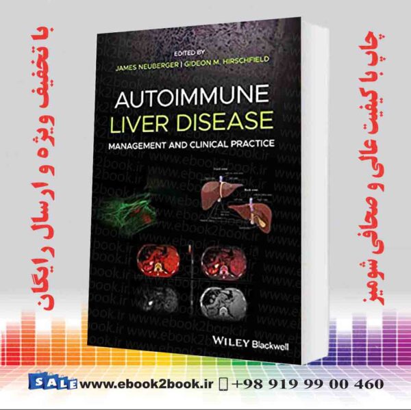 کتاب Autoimmune Liver Disease: Management And Clinical Practice