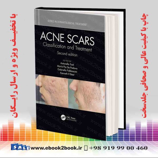 کتاب Acne Scars: Classification And Treatment 2Nd Edition