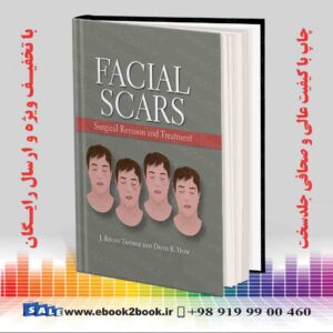 کتاب Facial Scars: Surgical Revision and Treatment 