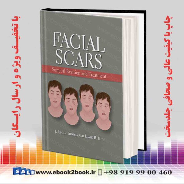 کتاب Facial Scars: Surgical Revision And Treatment 