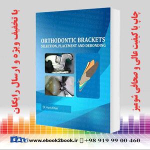 خرید کتاب پزشکی Orthodontic Brackets: Selection,Placement and Debonding
