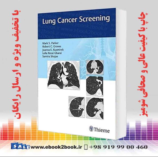 کتاب Lung Cancer Screening