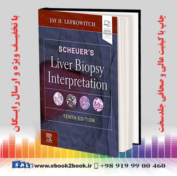 کتاب Scheuer'S Liver Biopsy Interpretation 10Th Edition