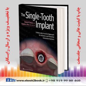 خرید کتاب پزشکی The Single-Tooth Implant 1st Edition