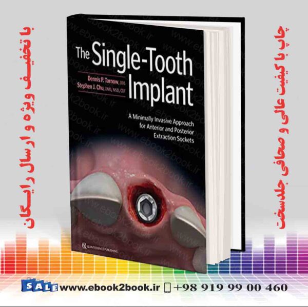 کتاب The Single-Tooth Implant