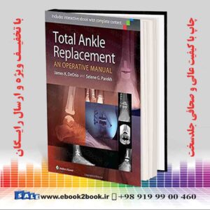 خرید کتاب Total Ankle Replacement: An Operative Manual First Edition