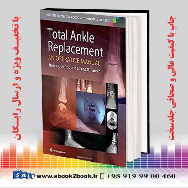 کتاب Total Ankle Replacement: An Operative Manual First Edition