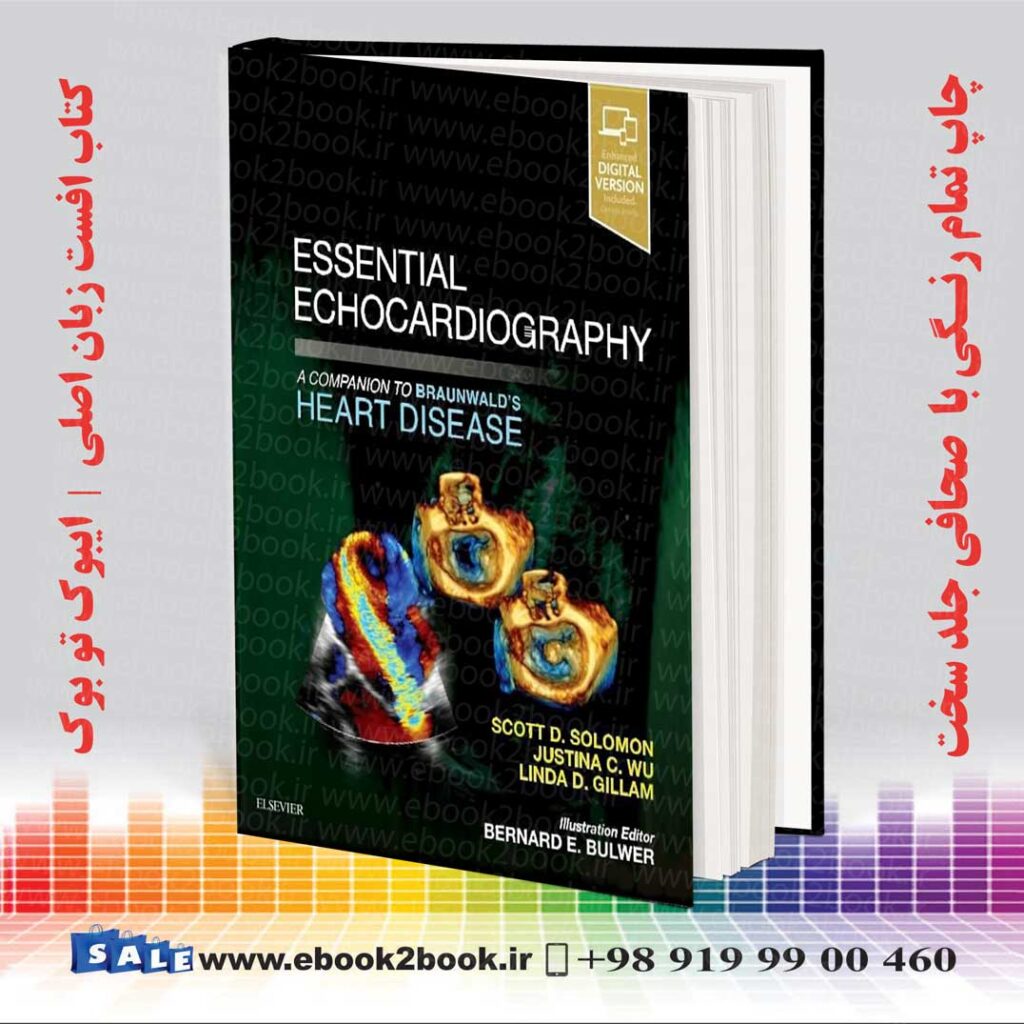 Essential Echocardiography: A Companion to Braunwald’s Heart Disease ...