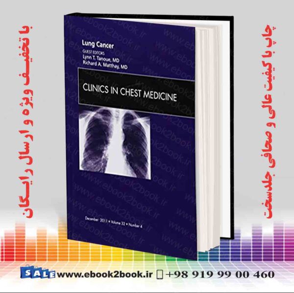 کتاب Lung Cancer, An Issue Of Clinics In Chest Medicine (Volume 32-4)