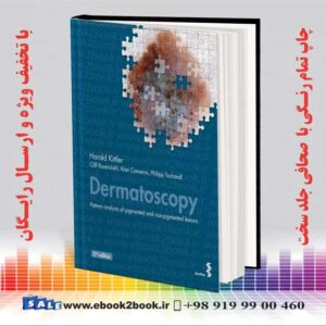 خرید کتاب Dermatoscopy: Pattern analysis of pigmented and non-pigmented lesions