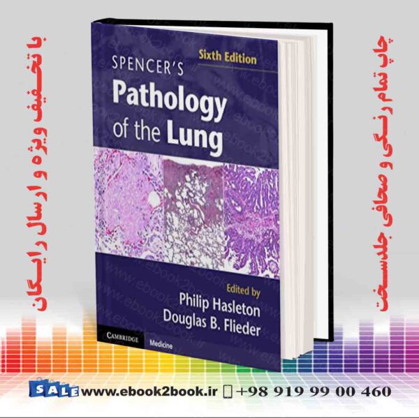 کتاب Spencer'S Pathology Of The Lung, 6Th Edition