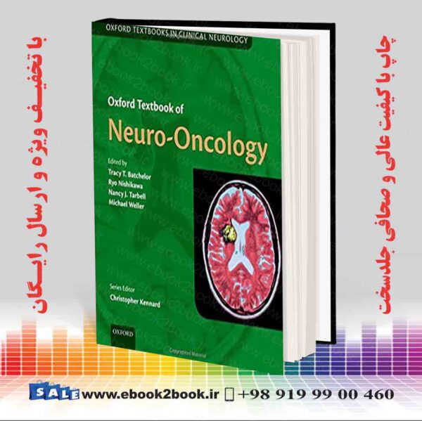 خرید کتاب Oxford Textbook Of Neuro-Oncology