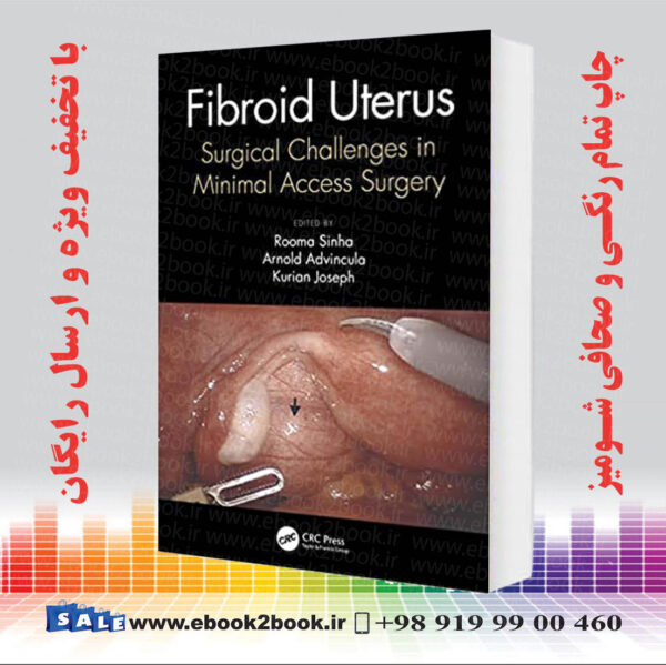 کتاب Fibroid Uterus