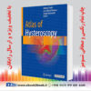 خرید کتاب Atlas of Hysteroscopy, 1st Edition