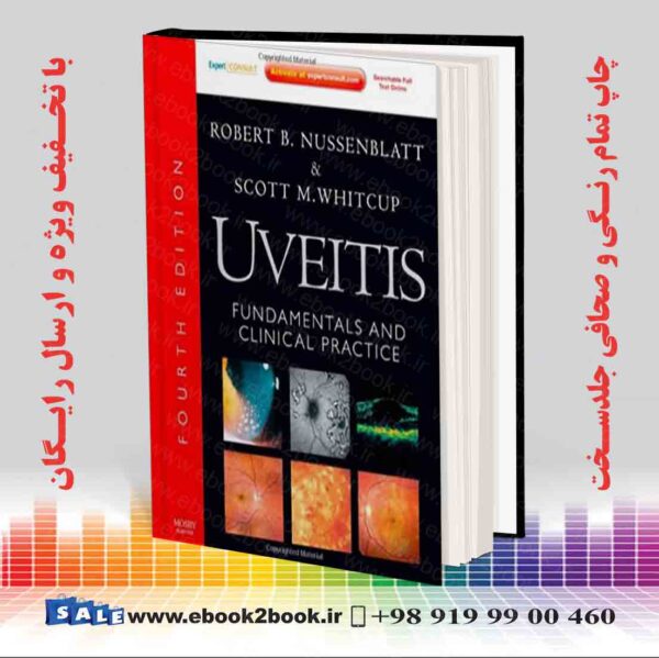 کتاب Uveitis: Fundamentals And Clinical Practice, 4Th Edition