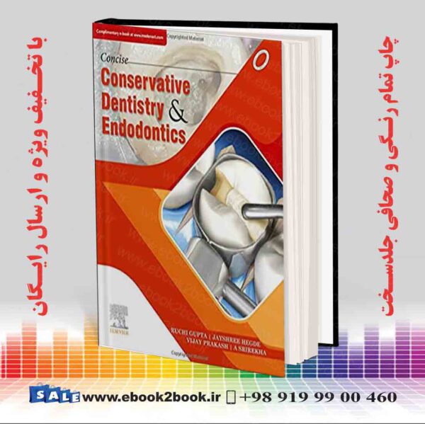 خرید کتاب Concise Conservative Dentistry and Endodontics