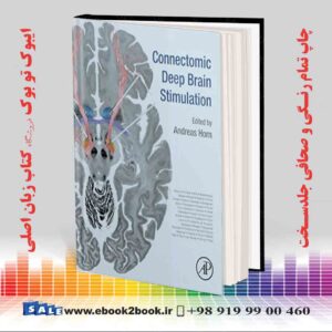 خرید کتاب Connectomic Deep Brain Stimulation