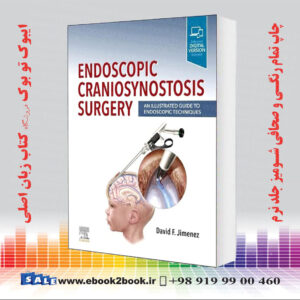 کتاب Endoscopic Craniosynostosis Surgery