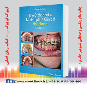کتاب The Orthodontic Mini-implant Clinical Handbook, 2nd Edition