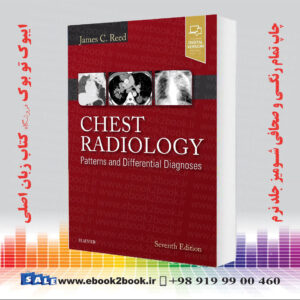 کتاب Chest Radiology: Patterns and Differential Diagnoses 7th Edition