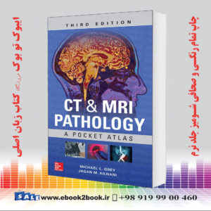 خرید کتاب CT and MRI Pathology: A Pocket Atlas, 3rd Edition