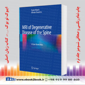 خرید کتاب MRI of Degenerative Disease of the Spine: A Case-Based Atlas 2nd Edition