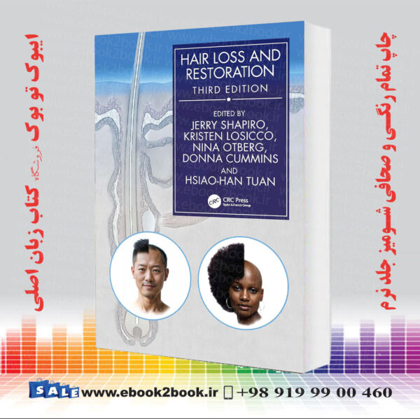 کتاب Hair Loss And Restoration 3Rd Edition