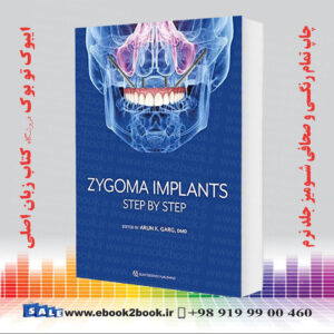 کتاب Zygoma Implants: Step by Step