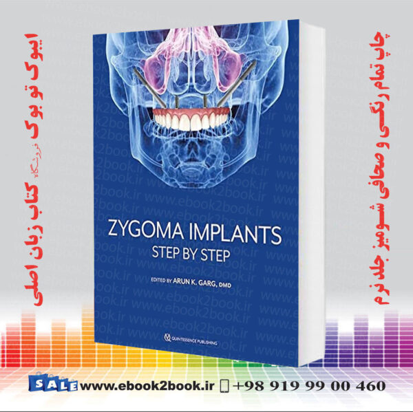 کتاب Zygoma Implants: Step By Step